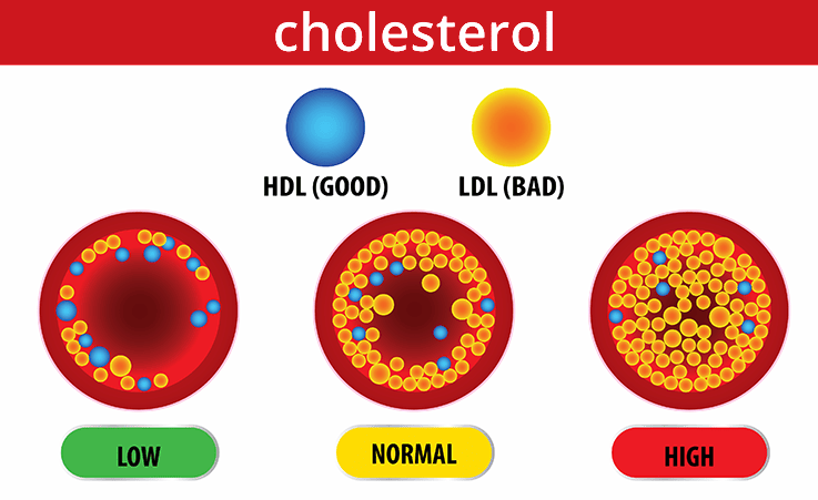 cholesterol graphic