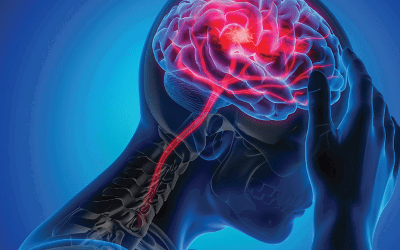 High Rate of Undiagnosed Major Risk Factors in Ischemic Stroke