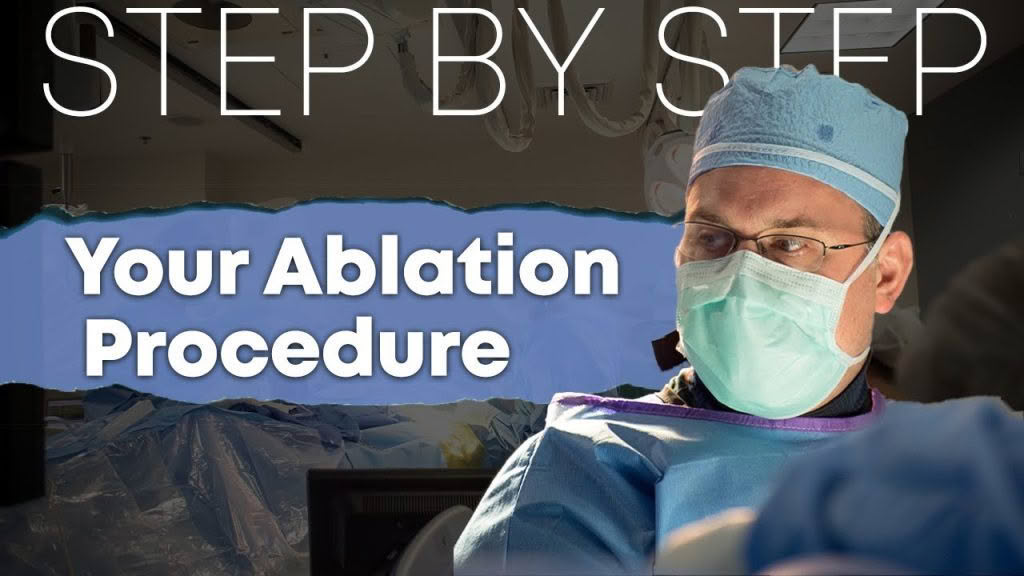 step by step, your ablation procedure thumbnail