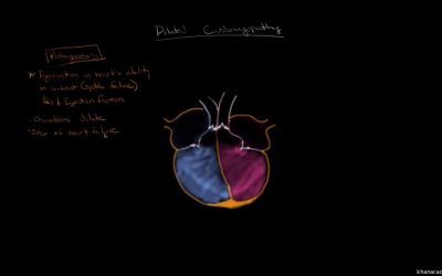 Dilated cardiomyopathy: Pathophysiology and diagnosis