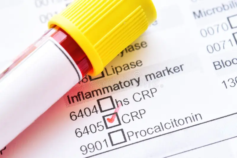 Rethinking HDL cholesterol